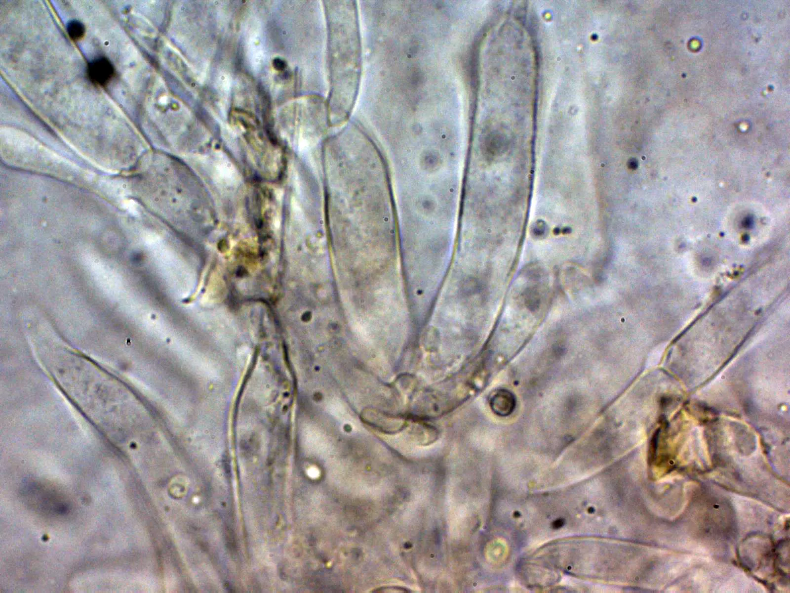 11 - Suprapellis agua 2